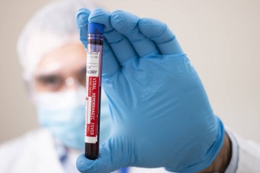 Elinde hayali bir test tüpü kan örneği tutan bir doktorun görüntüsü Viral hemorajik ateş virüsü bulaşmış..