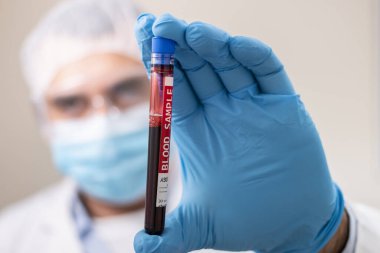 Elinde hayali bir test tüpü tutan bir doktorun görüntüsü. Virüs bulaşmış kan örneği..