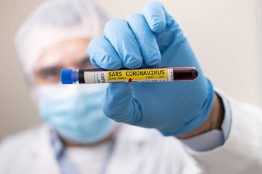 SARS koronavirüsüne yakalanmış kurgusal bir test tüpü kan örneğini elinde tutan bir doktorun görüntüsü..