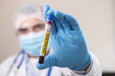 Sarı humma virüsü bulaşmış hayali bir test tüpü kan örneğini elinde tutan bir doktorun görüntüsü..