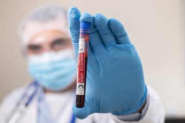 Elinde hayali bir test tüpü olan hepatit C virüsü bulaşmış bir doktorun görüntüsü..