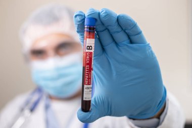 Doktorun elinde hayali bir test tüpü kan örneği tutarken Hepatit B virüsü bulaşmış..