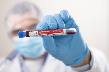 Coronavirus (covid-19) virüsü bulaşmış kurgusal bir test tüpü kan örneğini elinde tutan bir doktorun görüntüsü.