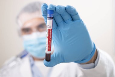 Coronavirus (covid-19) virüsü bulaşmış kurgusal bir test tüpü kan örneğini elinde tutan bir doktorun görüntüsü.