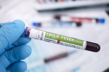 Ebola virüsü bulaşmış hayali kan örnekleri, steteskop, maske ve şırınga ve diğer şeyler..