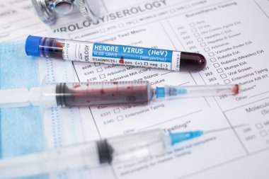 Henry virüsü taşıyan hayali kan örnekleri, maske, şırınga ve laboratuvar raporları..