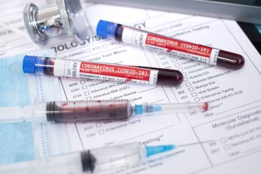 Enfeksiyon kapmış koronavirüslü (covid-19) hayali kan örnekleri, maske, şırınga ve laboratuvar raporlarıyla.