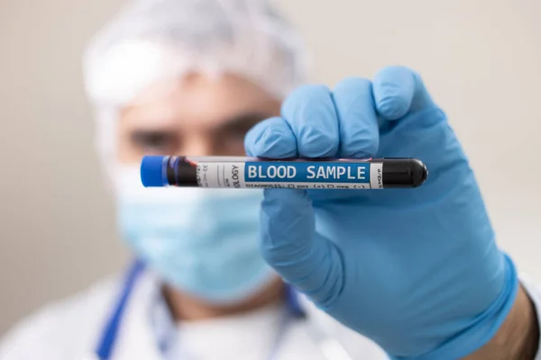 Vista Médico Sosteniendo Una Muestra Sangre Probeta Ficción Infectado Con —  Fotos de Stock