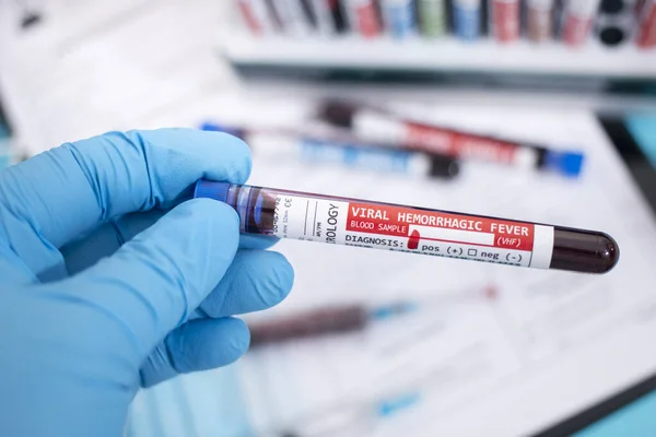 Fictieve Bloedmonsters Met Geïnfecteerd Viraal Hemorragisch Koorts Virus Met Stethoscoop — Stockfoto
