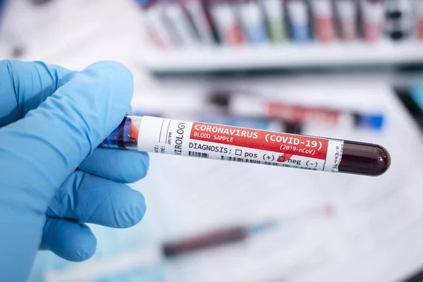 Fictional Blood Samples Infected Coronavirus Covid Stethoscope Mask Syringe Other — Stock Photo, Image
