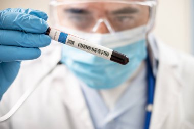 Bir doktorun elinde hayali bir test tüpü kan örneği tutarken görüntüsü, muhtemelen enfekte olmuş..