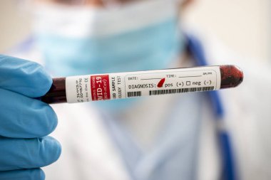 Kurgusal bir test tüpü kan örneği tutan bir doktorun görüntüsü, Coronavirus enfekte.