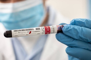 Kurgusal bir test tüpü kan örneği tutan bir doktorun görüntüsü, Coronavirus enfekte.