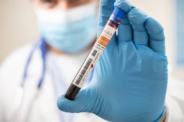 Kızamık virüsü bulaşmış kurgusal bir test tüpü kan örneğini elinde tutan bir doktorun görüntüsü..