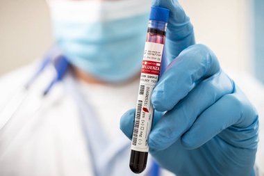 Elinde hayali bir test tüpü kan örneği tutan bir doktorun görüntüsü. Grip virüsü bulaşmış..