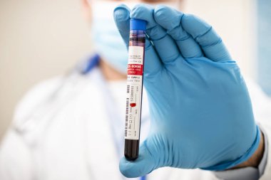 Elinde hayali bir test tüpü kan örneği tutan bir doktorun görüntüsü kene kaynaklı virüsle enfekte olmuş..