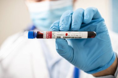 Elinde hayali bir test tüpü olan hepatit C virüsü bulaşmış bir doktorun görüntüsü..