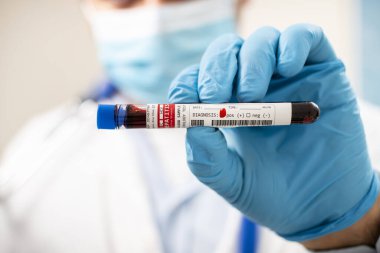 Elinde hayali bir test tüpü olan hepatit C virüsü bulaşmış bir doktorun görüntüsü..
