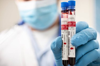 Kurgusal bir test tüpü tutan bir doktorun görüntüsü. Kan örnekleri, koronavirüs enfeksiyonu..