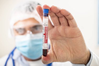 Doktorun elinde Rotavirüs virüsü bulaşmış hayali bir tüp kan örneği tuttuğunu görüyoruz..