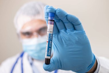 Batı Nil virüsü bulaşmış kurgusal bir test tüpü kan örneğini elinde tutan bir doktorun görüntüsü..