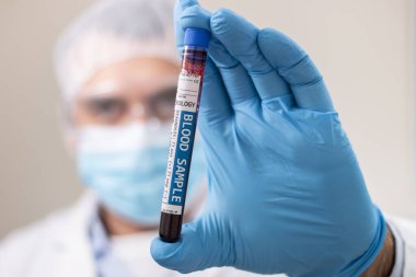 Elinde hayali bir test tüpü tutan bir doktorun görüntüsü. Virüs bulaşmış kan örneği..