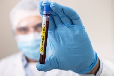 SARS koronavirüsüne yakalanmış kurgusal bir test tüpü kan örneğini elinde tutan bir doktorun görüntüsü..
