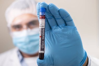 Marburg virüsü bulaşmış kurgusal bir test tüpü kan örneğini elinde tutan bir doktorun görüntüsü..