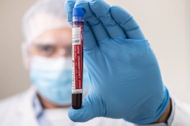 HlV / AIDS virüsü bulaşmış kurgusal bir test tüpü kan örneğini elinde tutan bir doktorun görüntüsü.