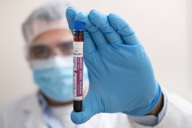 Kuduz virüsü bulaşmış kurgusal bir test tüpü kan örneğini elinde tutan bir doktorun görüntüsü..