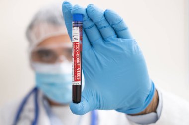 Elinde hayali bir test tüpü kan örneği tutan bir doktorun görüntüsü kene kaynaklı virüsle enfekte olmuş..