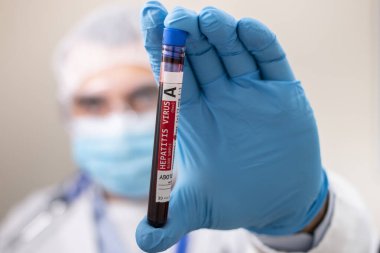 Elinde hayali bir test tüpü olan hepatit virüsü bulaşmış bir doktorun görüntüsü..