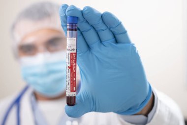Kurgusal bir test tüpü kan örneği tutan bir doktorun görüntüsü, insan gribi virüsü bulaşmış..