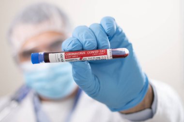 Coronavirus (covid-19) virüsü bulaşmış kurgusal bir test tüpü kan örneğini elinde tutan bir doktorun görüntüsü.