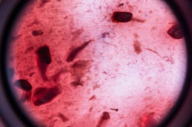 bakteri ve mikroorganizmalar, mikroskobik görünümü, makro arka plan taklit