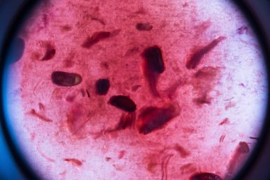 bakteri ve mikroorganizmalar, mikroskobik görünümü, makro arka plan taklit