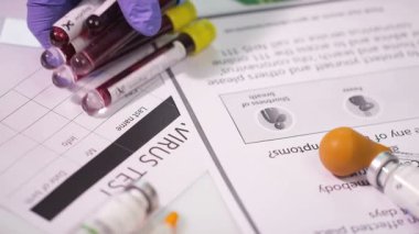 Coronavirus, COVID-19 kan testi makro yakın çekim. Coronavirus NCOV testi pozitif sonuç verdi. Tıbbi Görüntü. Kan testi konseptini işaretliyorum. SARS, MERS, FLU. Kırmızı kamerada yavaş çekim.