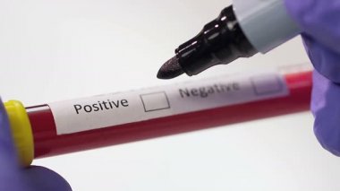 Coronavirus, COVID-19 kan testi makro yakın çekim. Coronavirus NCOV testi pozitif sonuç verdi. Tıbbi Görüntü. Kan testi konseptini işaretliyorum. SARS, MERS, FLU. Kırmızı kamerada yavaş çekim.