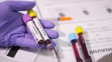 Coronavirus, COVID-19 kan testi makro yakın çekim. Coronavirus NCOV testi pozitif sonuç verdi. Tıbbi Görüntü. Kan testi konseptini işaretliyorum. SARS, MERS, FLU. Kırmızı kamerada yavaş çekim.