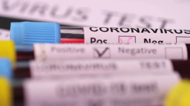 Coronavirus, COVID-19 kan testi makro yakın çekim. Coronavirus NCOV testi pozitif sonuç verdi. Tıbbi Görüntü. Kan testi konseptini işaretliyorum. SARS, MERS, FLU. Kırmızı kamerada yavaş çekim.