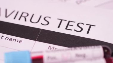 Coronavirus, COVID-19 kan testi makro yakın çekim. Coronavirus NCOV testi pozitif sonuç verdi. Tıbbi Görüntü. Kan testi konseptini işaretliyorum. SARS, MERS, FLU. Kırmızı kamerada yavaş çekim.
