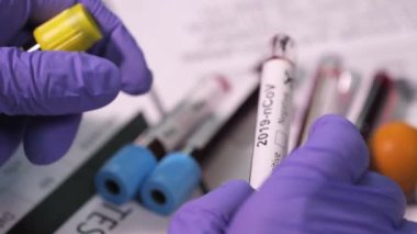 Coronavirus, COVID-19 kan testi makro yakın çekim. Coronavirus NCOV testi pozitif sonuç verdi. Tıbbi Görüntü. Kan testi konseptini işaretliyorum. SARS, MERS, FLU. Kırmızı kamerada yavaş çekim.