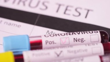 Coronavirus, COVID-19 kan testi makro yakın çekim. Coronavirus NCOV testi pozitif sonuç verdi. Tıbbi Görüntü. Kan testi konseptini işaretliyorum. SARS, MERS, FLU. Kırmızı kamerada yavaş çekim.