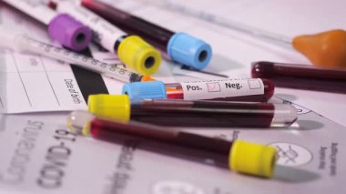 Coronavirus, COVID-19 kan testi makro yakın çekim. Coronavirus NCOV testi pozitif sonuç verdi. Tıbbi Görüntü. Kan testi konseptini işaretliyorum. SARS, MERS, FLU. Kırmızı kamerada yavaş çekim.