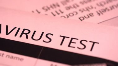 Coronavirus, COVID-19 kan testi makro yakın çekim. Coronavirus NCOV testi pozitif sonuç verdi. Tıbbi Görüntü. Kan testi konseptini işaretliyorum. SARS, MERS, FLU. Kırmızı kamerada yavaş çekim.