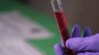 Coronavirus, COVID-19 kan testi makro yakın çekim. Coronavirus NCOV testi pozitif sonuç verdi. Tıbbi Görüntü. Kan testi konseptini işaretliyorum. SARS, MERS, FLU. Kırmızı kamerada yavaş çekim.