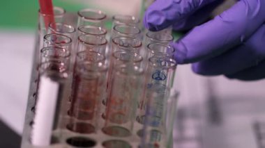 Coronavirus, COVID-19 kan testi makro yakın çekim. Coronavirus NCOV testi pozitif sonuç verdi. Tıbbi Görüntü. Kan testi konseptini işaretliyorum. SARS, MERS, FLU. Kırmızı kamerada yavaş çekim.