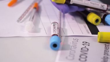 Coronavirus, COVID-19 kan testi makro yakın çekim. Coronavirus NCOV testi pozitif sonuç verdi. Tıbbi Görüntü. Kan testi konseptini işaretliyorum. SARS, MERS, FLU. Kırmızı kamerada yavaş çekim.