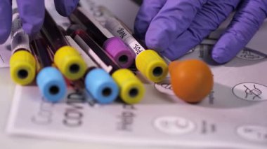 Coronavirus, COVID-19 kan testi makro yakın çekim. Coronavirus NCOV testi pozitif sonuç verdi. Tıbbi Görüntü. Kan testi konseptini işaretliyorum. SARS, MERS, FLU. Kırmızı kamerada yavaş çekim.