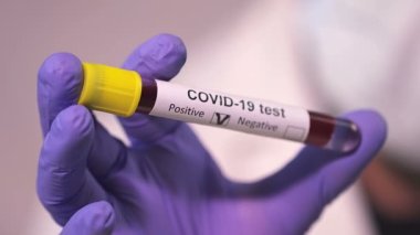 Coronavirus, COVID-19 kan testi makro yakın çekim. Coronavirus NCOV testi pozitif sonuç verdi. Tıbbi Görüntü. Kan testi konseptini işaretliyorum. SARS, MERS, FLU. Kırmızı kamerada yavaş çekim.